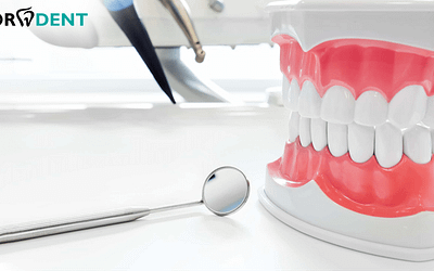 Prótese Dentária: o que você deve saber sobre o assunto?