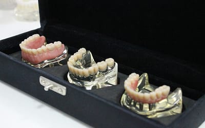 Conheça os principais tipos de implantes dentários e suas funções.